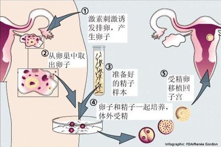 专业同志代怀服务收费标准